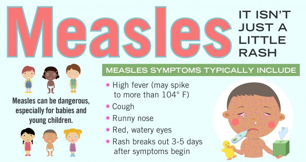 Public Health Advisory: Rise in U.S. Measles Cases | Nantucket ...